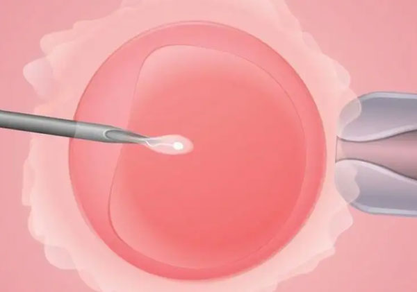 精子畸形率99%做二代试管会不会有畸形胎?